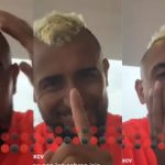 Arturo Vidal Precupante Estado De Ebriedad