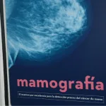 Mamografías (1)